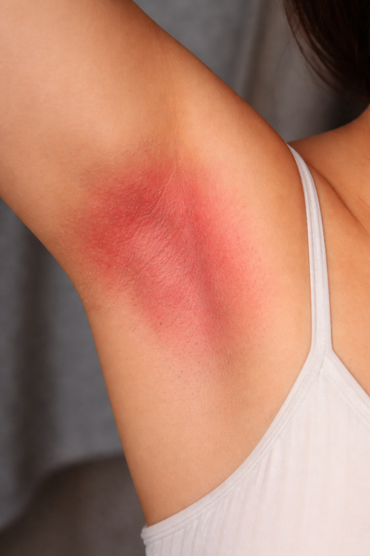  Frau sprüht Naturdeo unter Arm – reizfreie Anwendung