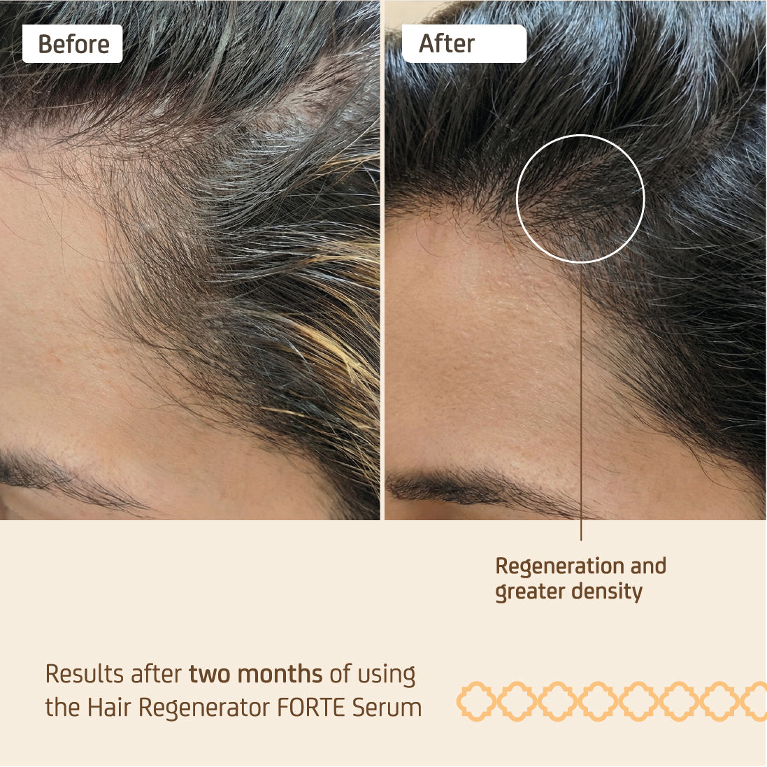 Nuggela & Sulé Hair Regenerator Serum Forte - 70 ml